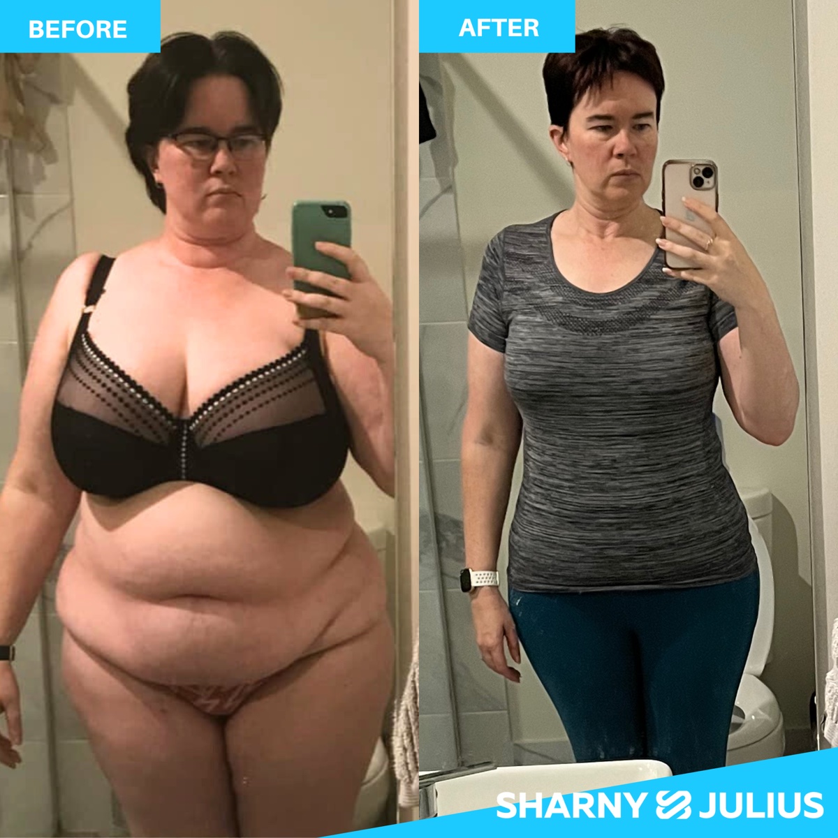 Alana S. — FHHM before and after transformation