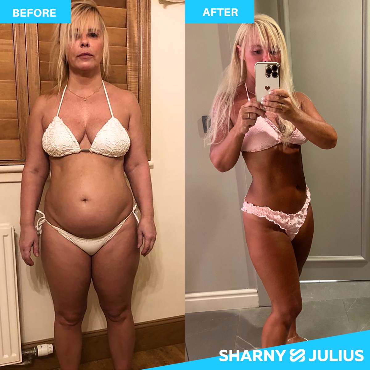 Caroline L. — FHHM before and after transformation