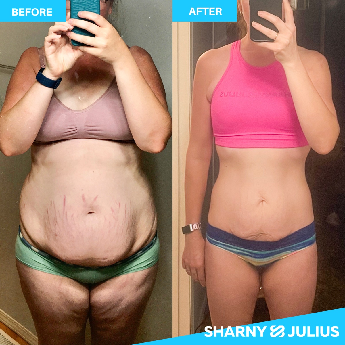 Chanel H. — FHHM before and after transformation