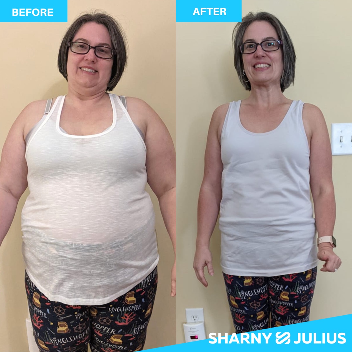 Summer T. — FHHM before and after transformation